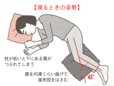 変形性膝関節症について および当院の施術事例 訪問リハビリマッサージ 鍼灸なら たにぐち鍼灸整体院 変形性膝関節症について および当院の施術事例 訪問リハビリマッサージ 鍼灸なら たにぐち鍼灸整体院