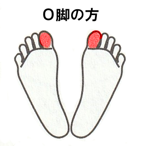 O脚の方：足先を少し開き、左右の親指に重心をかける